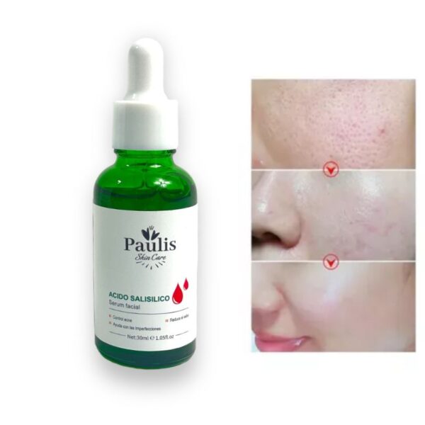 Serum antiacné con acido salicílico - Image 2