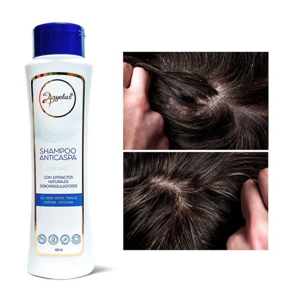 Shampoo Anticaspa Anyeluz - Image 3