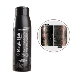 Shampoo Anticaspa Magic Hair