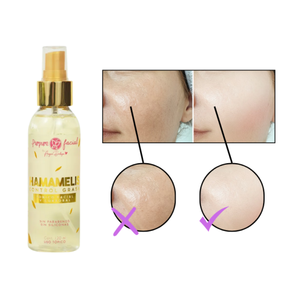 Tónico control grasa antiacné hamamelis 120 ml pequeño - Image 2